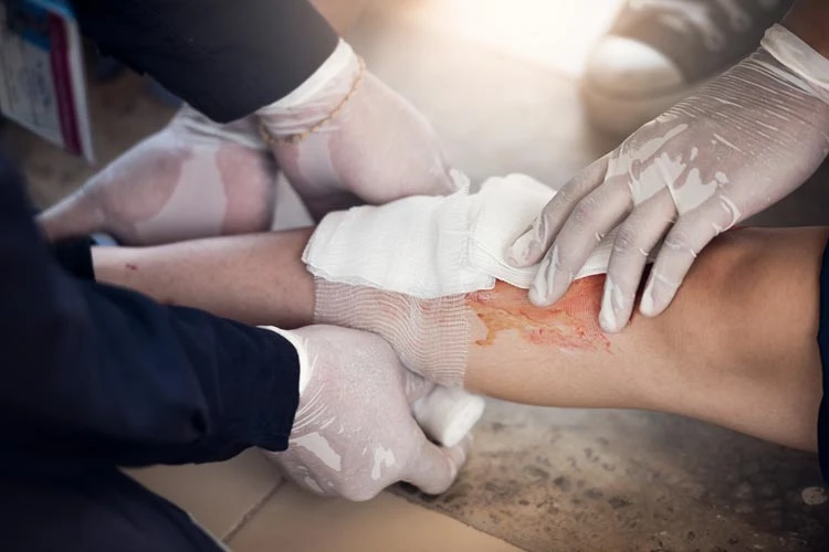 A pressure bandage is first aid for bleeding